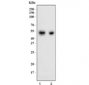 Western blot testing of human 1) MOLT4 and 2) Jurkat cell lysate with CD2 antibody. Expected molecular weight ~47 kDa.