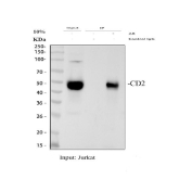 Immunoprecipitation of CD2 protein from 500ug of human Jurkat whole cell lysate with 2ug of CD2 antibody.