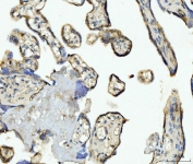 IHC staining of FFPE human placental tissue with CD93 antibody. HIER: boil tissue sections in pH8 EDTA for 20 min and allow to cool before testing.