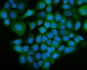 Immunofluorescent staining of FFPE human A431 cells with ECD antibody (green) and DAPI nuclear stain (blue). HIER: steam section in pH6 citrate buffer for 20 min.
