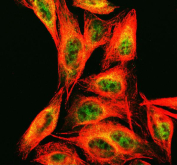 Immunofluorescent staining of FFPE human A431 cells with ECD antibody (green) and DAPI nuclear stain (blue). HIER: steam section in pH6 citrate buffer for 20 min.