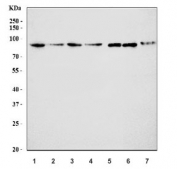 Western blot testing of 1) human MCF7, 2) human A431, 3) human T-47D, 4) human SiHa, 5) rat stomach, 6) mouse stomach and 7) mouse pancreas tissue lysate with MENA antibody. Predicted molecular weight ~66 kDa but can be observed at ~90 kDa.