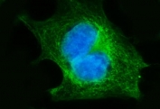 Immunofluorescent staining of FFPE human Caco-2 cells with Fibroblast Growth Factor Receptor 3 antibody (green) and DAPI nuclear stain (blue). HIER: steam section in pH6 citrate buffer for 20 min.