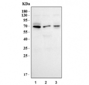 Western blot testing of human 1) 293T, 2) MCF7 and 3) PC-3 cell lysate with GATA6 antibody. Predicted molecular weight ~60 kDa.