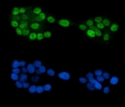Immunofluorescent staining of FFPE human A431 cells with GATA6 antibody (green) and DAPI nuclear stain (blue). HIER: steam section in pH6 citrate buffer for 20 min.