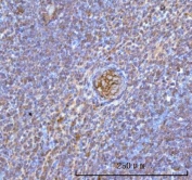 IHC staining of FFPE human spleen tissue with Hemoglobin alpha antibody. HIER: boil tissue sections in pH8 EDTA for 20 min and allow to cool before testing.