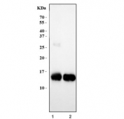 Western blot testing of 1) human placenta and 2) mouse heart tissue lysate with Hemoglobin alpha antibody. Predicted molecular weight ~15 kDa.