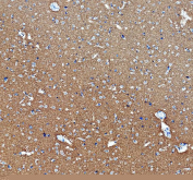 Immunohistochemical staining of FFPE human brain tissue with MAPT antibody, HRP-secondary and DAB substrate. HIER: boil tissue sections in pH8 EDTA for 20 min and allow to cool before testing.
