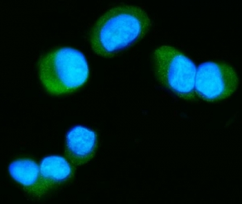 Immunofluorescent staining of FFPE human T-47D cells with MAPT antibody (green) and DAPI nuclear stain (blue). HIER: steam section in pH6 citrate buffer for 20 min.~