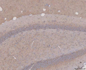 Immunohistochemical staining of FFPE mouse brain tissue with MAPT antibody, HRP-secondary and DAB substrate. HIER: boil tissue sections in pH8 EDTA for 20 min and allow to cool before testing.