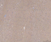 Immunohistochemical staining of FFPE rat brain tissue with MAPT antibody, HRP-secondary and DAB substrate. HIER: boil tissue sections in pH8 EDTA for 20 min and allow to cool before testing.