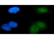 Immunofluorescent staining of FFPE human U-2 OS cells with MSL2 antibody (green) and DAPI nuclear stain (blue). HIER: steam section in pH6 citrate buffer for 20 min.