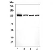 Western blot testing of 1) human HeLa, 2) human K562, 3) rat brain and 4) mouse brain tissue lysate with Monofunctional C1-tetrahydrofolate synthase antibody. Predicted molecular weight ~106 kDa.