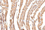 IHC staining of FFPE rat heart tissue with Myosin 6 antibody. HIER: boil tissue sections in pH8 EDTA for 20 min and allow to cool before testing.
