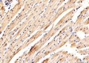 IHC staining of FFPE mouse heart tissue with Myosin 6 antibody. HIER: boil tissue sections in pH8 EDTA for 20 min and allow to cool before testing.