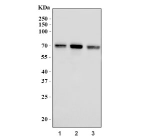 Western blot testing of human 1) HeLa, 2) MCF7 and 3) Caco-2 cell lysate with BTBD14B antibody. Predicted molecular weight: ~57 kDa, commonly observed at 57-70 kDa.