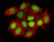 Immunofluorescent staining of FFPE human MCF7 cells with BTBD14B antibody (green) and phalloidin (red). HIER: steam section in pH6 citrate buffer for 20 min.