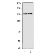 Western blot testing of 1) rat brain and 2) mouse brain tissue lysate with Nitric oxide synthase antibody. Predicted molecular weight ~160 kDa.