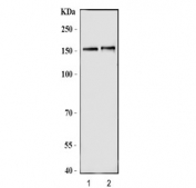 Western blot testing of 1) rat brain and 2) mouse brain tissue lysate with Nitric oxide synthase antibody. Predicted molecular weight ~160 kDa.