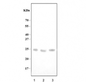 Western blot testing of 1) human HACAT, 2) rat PC-12 and 3) mouse lung tissue lysate with PDGF alpha antibody. Predicted molecular weight ~24 kDa (long form), ~22 kDa (short form).