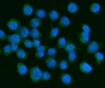 Immunofluorescent staining of FFPE human SiHa cells with PDGF alpha antibody (green) and DAPI nuclear stain (blue). HIER: steam section in pH6 citrate buffer for 20 min.~