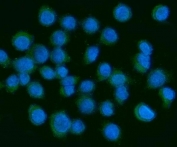 Immunofluorescent staining of FFPE human SiHa cells with PDGF alpha antibody (green) and DAPI nuclear stain (blue). HIER: steam section in pH6 citrate buffer for 20 min.