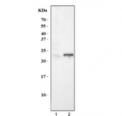 Western blot testing of 1) rat heart and 2) mouse heart tissue lysate with PLB antibody. Predicted molecular weight: 6/12/18/24 kDa (monomer/dimer/oligomers).