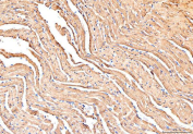 IHC staining of FFPE mouse heart tissue with PLB antibody. HIER: boil tissue sections in pH8 EDTA for 20 min and allow to cool before testing.