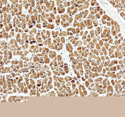 IHC staining of FFPE human heart tissue with PLB antibody, HRP-secondary and DAB substrate. HIER: boil tissue sections in pH8 EDTA for 20 min and allow to cool before testing.