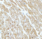 IHC staining of FFPE human heart tissue with PLB antibody, HRP-secondary and DAB substrate. HIER: boil tissue sections in pH8 EDTA for 20 min and allow to cool before testing.