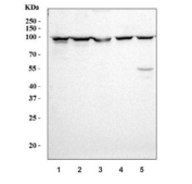 Western blot testing of 1) human HepG2, 2) human 293T, 3) human K562, 4) human PC-3 and 5) rat brain tissue lysate with Prospero homeobox protein 1 antibody. Predicted molecular weight is 83 kDa, observed at 80-110 kDa.