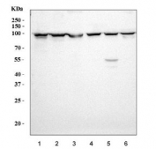 Western blot testing of 1) human HepG2, 2) human 293T, 3) human K562, 4) human PC-3, 5) rat brain and 6) mouse brain tissue lysate with Prospero homeobox protein 1 antibody. Predicted molecular weight is 83 kDa, observed at 80-110 kDa.