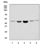 Western blot testing of 1) human RT4, 2) human MCF7, 3) human Caco-2, 4) rat brain and 5) mouse brain tissue lysate with PSEN1 antibody. Predicted molecular weight ~53 kDa.