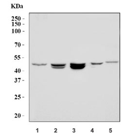 Western blot testing of 1) human RT4, 2) human MCF7, 3) human Caco-2, 4) rat brain and 5) mouse brain tissue lysate with PSEN1 antibody. Predicted molecular weight ~53 kDa.