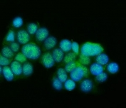 Immunofluorescent staining of FFPE human RT4 cells with PSEN1 antibody (green) and DAPI nuclear stain (blue). HIER: steam section in pH6 citrate buffer for 20 min.