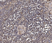 IHC staining of FFPE human splenic rupture tissue with PSMD8 antibody. HIER: boil tissue sections in pH8 EDTA for 20 min and allow to cool before testing.