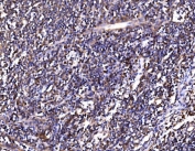 IHC staining of FFPE human tonsil tissue with PSMD8 antibody. HIER: boil tissue sections in pH8 EDTA for 20 min and allow to cool before testing.
