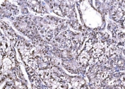 IHC staining of FFPE human liver tissue with PSMD8 antibody. HIER: boil tissue sections in pH8 EDTA for 20 min and allow to cool before testing.