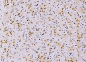 IHC staining of FFPE mouse brain tissue with PSMD8 antibody. HIER: boil tissue sections in pH8 EDTA for 20 min and allow to cool before testing.