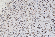 IHC staining of FFPE rat brain tissue with PSMD8 antibody. HIER: boil tissue sections in pH8 EDTA for 20 min and allow to cool before testing.