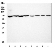 Western blot testing of 1) human 293T, 2) human SK-O-V3, 3) human HeLa, 4) human SiHa, 5) rat ovary, 6) rat heart, 7) mouse ovary and 8) mouse heart tissue lysate with CYP8A1 antibody. Expected molecular weight: ~57 kDa.