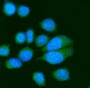 Immunofluorescent staining of FFPE human SiHa cells with CD155 antibody (green) and DAPI nuclear stain (blue). HIER: steam section in pH6 citrate buffer for 20 min.