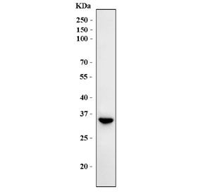 Western blot testing of human HeLa cell lysate with RPS2 antibody. Predicted molecular weight ~31 kDa.