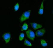 Immunofluorescent staining of FFPE human HeLa cells with RPS2 antibody (green) and DAPI nuclear stain (blue). HIER: steam section in pH6 citrate buffer for 20 min.