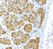 IHC staining of FFPE human stomach tissue with RPS2 antibody, HRP-secondary and DAB substrate. HIER: boil tissue sections in pH8 EDTA for 20 min and allow to cool before testing.