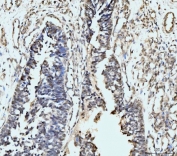 IHC staining of FFPE human bladder epithelial tissue with RPS6KA4 antibody. HIER: boil tissue sections in pH8 EDTA for 20 min and allow to cool before testing.
