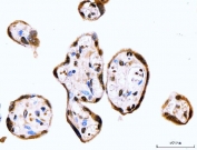 IHC staining of FFPE human placental tissue with RPS6KA4 antibody. HIER: boil tissue sections in pH8 EDTA for 20 min and allow to cool before testing.