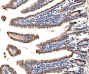 IHC staining of FFPE mouse colon tissue with RPS6KA4 antibody. HIER: boil tissue sections in pH8 EDTA for 20 min and allow to cool before testing.