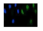 Immunofluorescent staining of FFPE human PC-3 cells with RPS6KA4 antibody (green) and DAPI nuclear stain (blue). HIER: steam section in pH6 citrate buffer for 20 min.