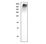 Western blot testing of human placental tissue lysate with RYR2 antibody. Predicted molecular weight ~565 kDa.